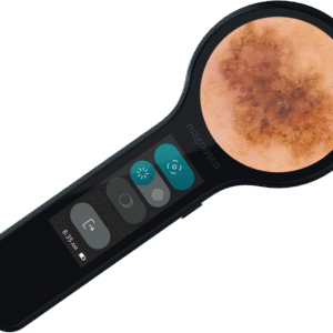 Magnosco Dermatoscope
